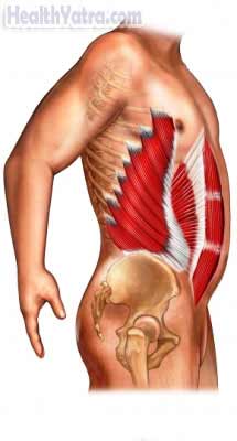 Abdominal Muscle Strain, Causes, Symptoms, and Cost Surgery Treatment in India Abdominal Muscle Strain