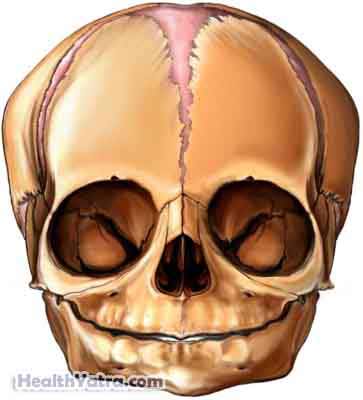 Dehydration Definition, Causes, Symptoms, Complications and Cost Surgery Treatment Hospital in India Dehydration
