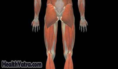 Gluteal Strain Gluteal Strain