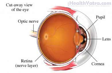 Nearsightedness and Farsightedness