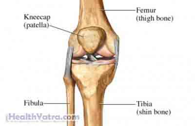 Patellofemoral Pain Syndrome