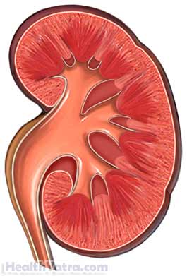 Polycystic Kidney Disease Polycystic Kidney Disease