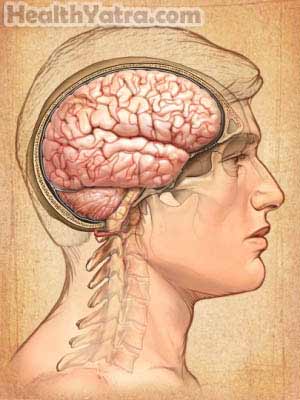 Post traumatic Stress Disorder
