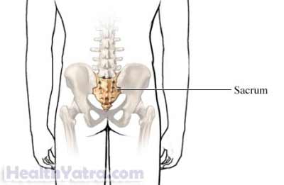 Sacral Stress Fracture Treatment in India, Causes, Symptoms and Top Hospital Sacral Stress Fracture