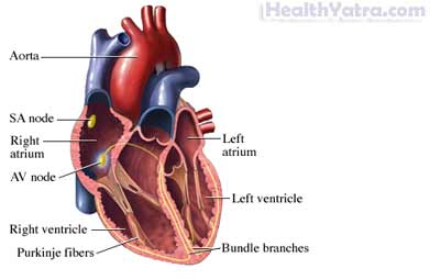 Sick Sinus Syndrome Treatment in India, Causes, Symptoms and Top Hospital Sick Sinus Syndrome