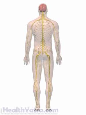 Somatization Disorder Somatization Disorder