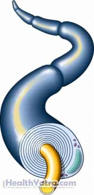 X-linked Adrenoleukodystrophy X linked Adrenoleukodystrophy