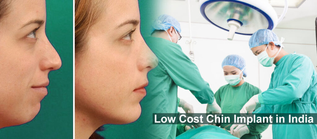 Low Cost Chin Implant in India or Chin Augmentation Cosmetic Surgery in India Low Cost Chin Implant in India