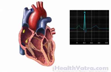 Ambulatory Cardiac Monitoring2