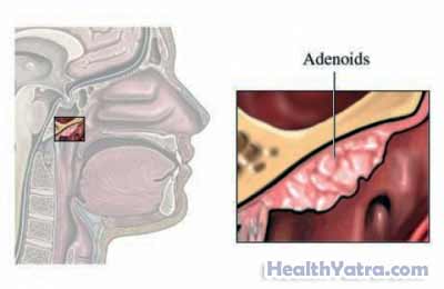 Anatomy of the Adenoids