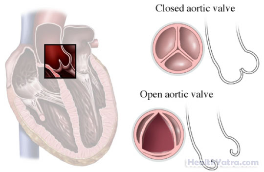 Aortic Valve–Opened and Closed