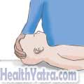 Cardiopulmonary Resuscitation for Infants 2