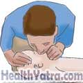Cardiopulmonary Resuscitation for Infants 3