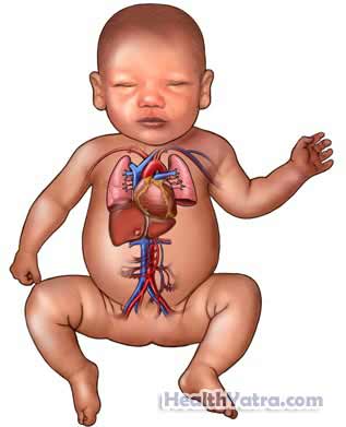 Cardiopulmonary Resuscitation for Infants 4