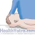 Cardiopulmonary Resuscitation for Infants2