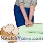 Cardiopulmonary Resuscitation for Teens and Adults 1
