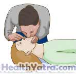 Cardiopulmonary Resuscitation for Teens and Adults 2