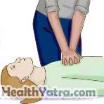 Cardiopulmonary Resuscitation for Teens and Adults 3