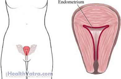Endometrial Biopsy