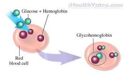 Hemoglobin Test