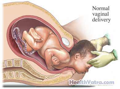 Labor and Delivery Vaginal Birth