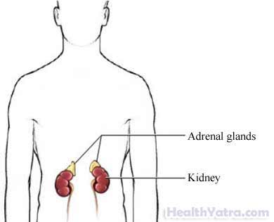 Adrenalectomy Open Surgery