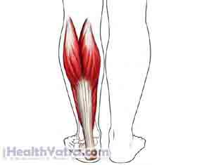 Calf Muscle Tears: Symptoms, Complications, and Treatments