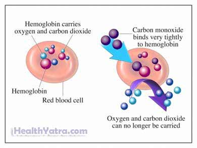 कार्बन मोनोऑक्साइड विषाक्तता
