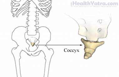 Coccyx Fracture