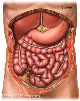 Gastrectomy 2