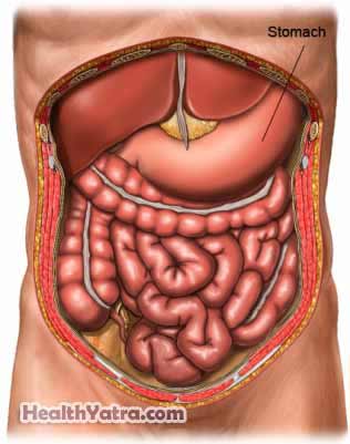 Gastrectomy 3