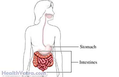 Ischemic Bowel Disease