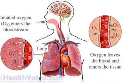 العلاج بالأوكسجين