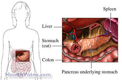 Pancreratic Cance