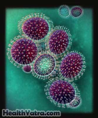 महामारी H1N1 इन्फ्लुएंजा