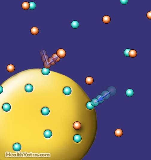 Premenstrual Dysphoric Disorder