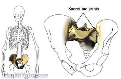 Sacroiliac Joint Pain