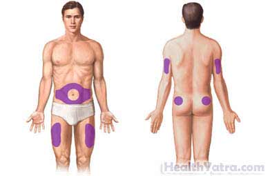 Subcutaneous Injection2