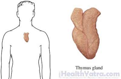 Thymectomy