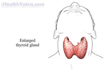 Thyroid Uptake and Scan