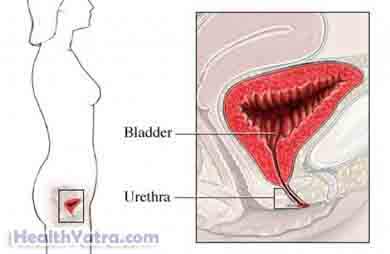 Urethral Suspension Tension Free Vaginal Tape Procedure 2