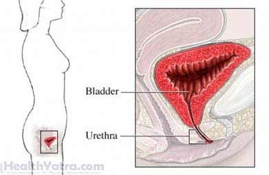 Urethral Suspension Tension Free Vaginal Tape Procedure