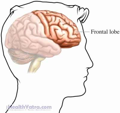 Schizotypal Personality Disorder