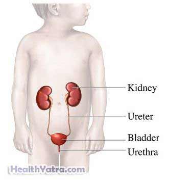 Urinary Tract Infections in Childhood