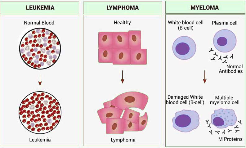 Types of Blood Cancer and Treatment in India