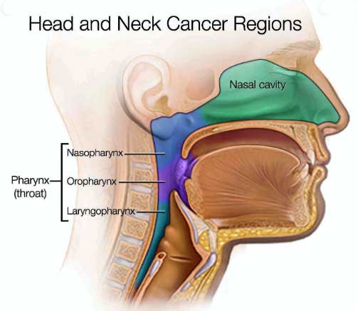 Cancers of the head and neck are further identified by the area in which they begin