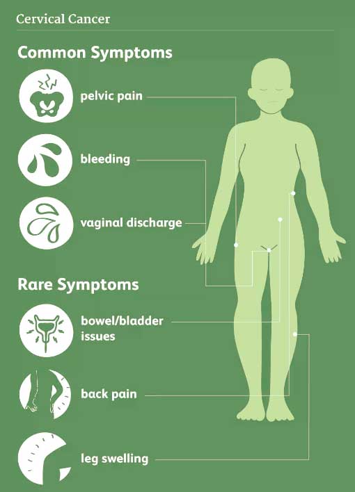 أعراض سرطان عنق الرحم