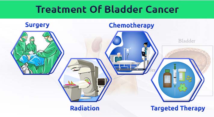 Bladder Cancer Treatment In India