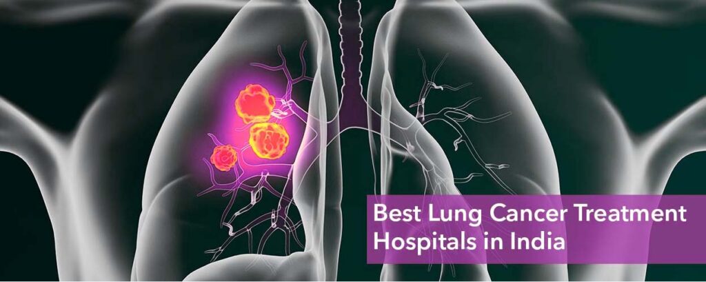 Lung cancer treatment India