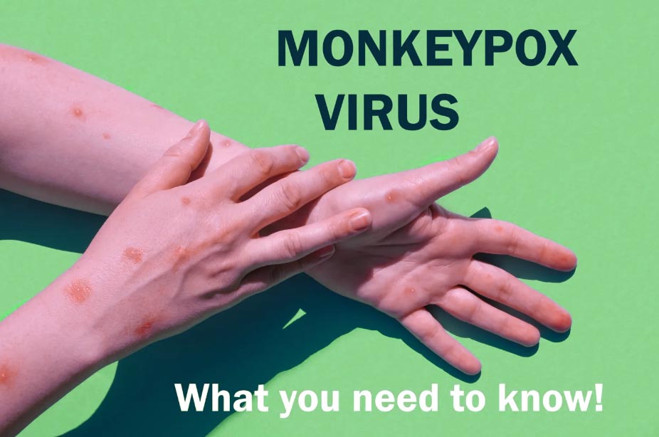 Monkeypox Symptoms pictures treatments vaccines What you need to know